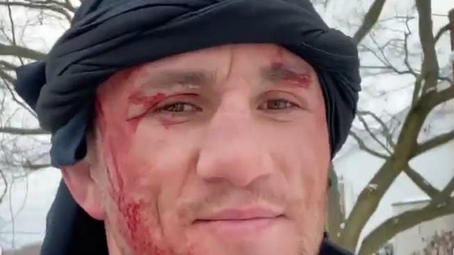 Gruzínský bojovník z UFC podcenil soupeře v podobě zamrzlého rybníku a pořezal si obličej