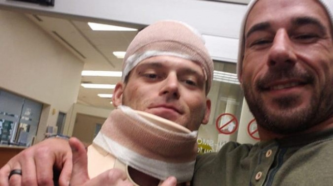 Hrozivé zranění v MMA! Amatérský bojovník byl v kleci málem skalpován