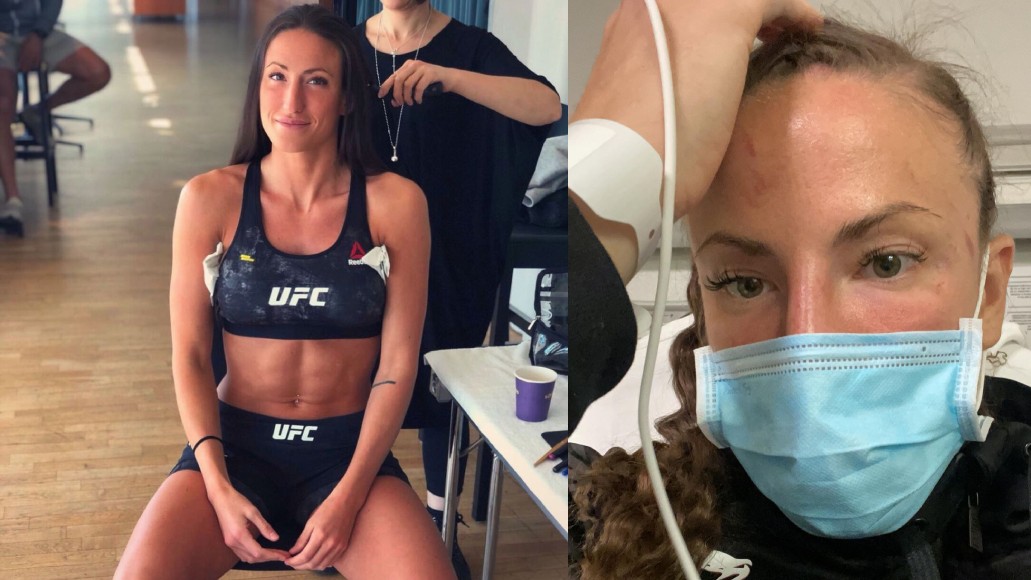 Bojovnice přiznala problémy s mozkem po tvrdém KO, přesto doufá, že se do boje vrátí