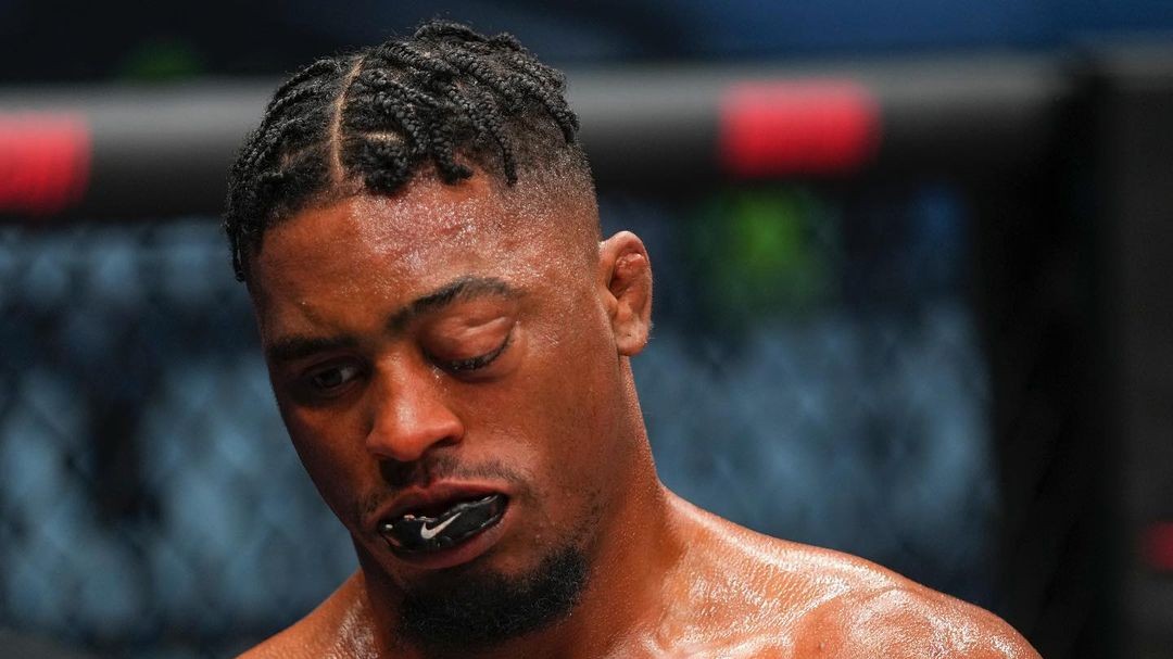 Takové zranění jsme v MMA ještě neměli. Bojovníkovi doslova vylezlo oko z důlku!