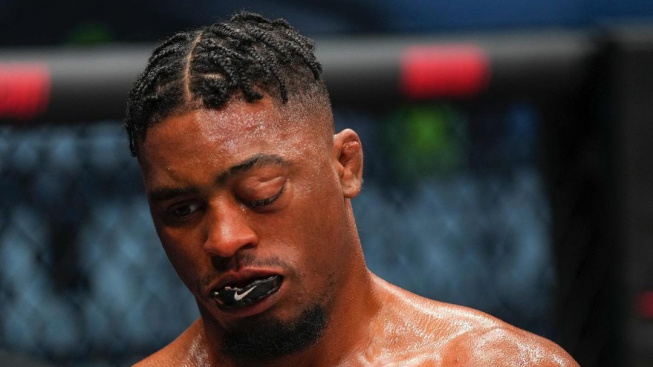 Takové zranění jsme v MMA ještě neměli. Bojovníkovi doslova vylezlo oko z důlku!