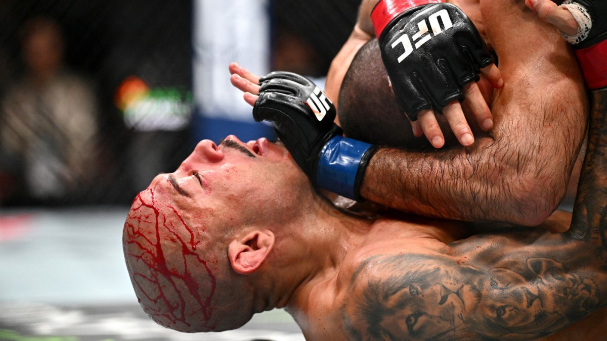 A s tím šel do klece? José Aldo přiznal nepříjemné zdravotní problémy